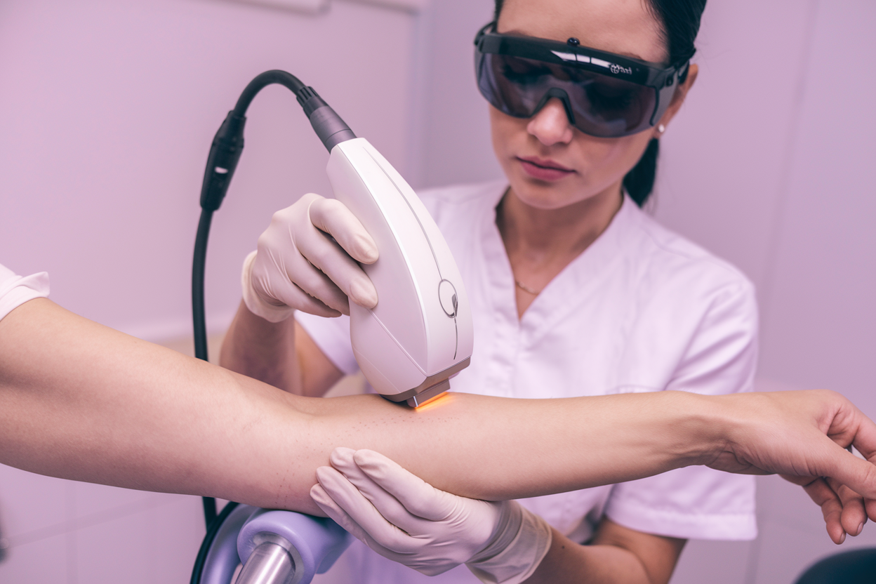 Depilacja laserowa całe ciało (od 4 partii)